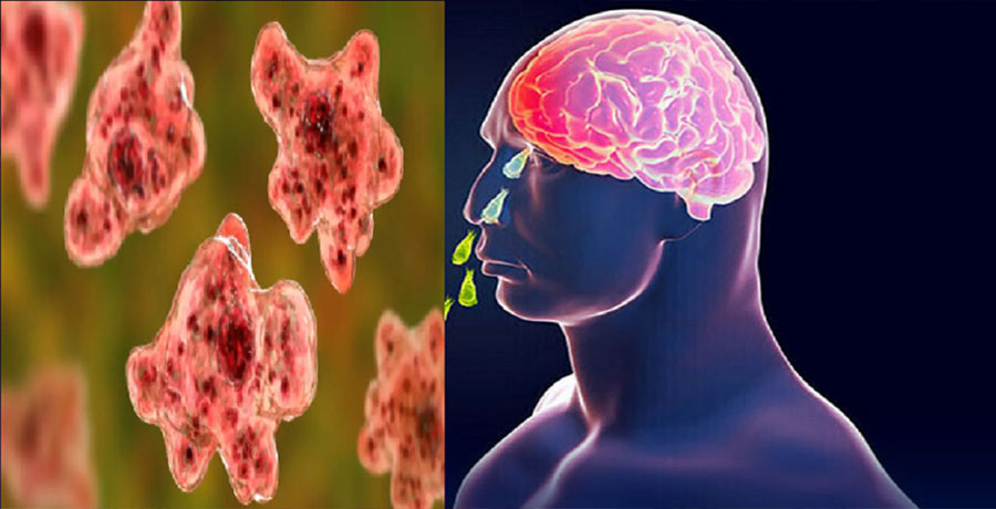 অ্যামিবা আক্রমণে ১৯ মৃত্যু, কীভাবে সংক্রমণ হয় জানুন