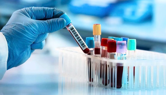 নতুন এক রক্ত পরীক্ষায় ৫০টিরও বেশি ক্যানসার শনাক্ত সম্ভব