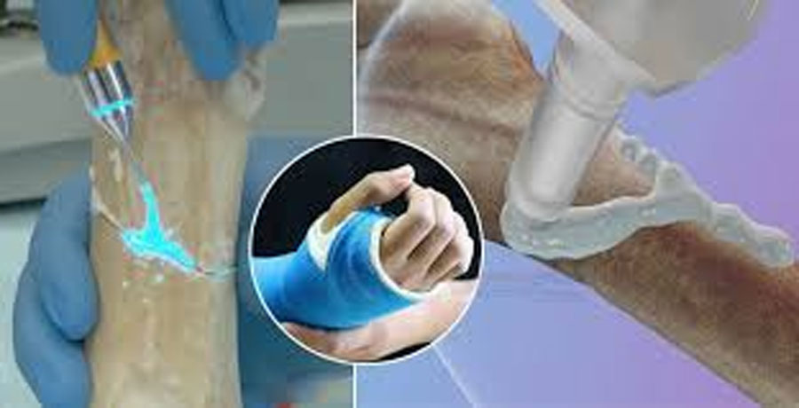 সার্জারি ছাড়াই দ্রুত হাড় যুক্ত করার বিপ্লবী প্রযুক্তি